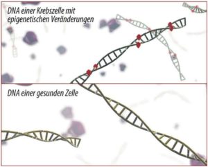 Eine neue Alternative zur Abklärung von Auffälligkeiten bei der Gebärmutterhalskrebsvorsorge bieten molekularbiologische Tests.