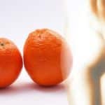 Unter Cellulite leiden viele Menschen, hauptsächlich Frauen.