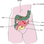 Endometriose bleibt in der Regel lange unentdeckt.