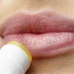2023-05-02-Herpes