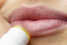 2023-05-02-Herpes